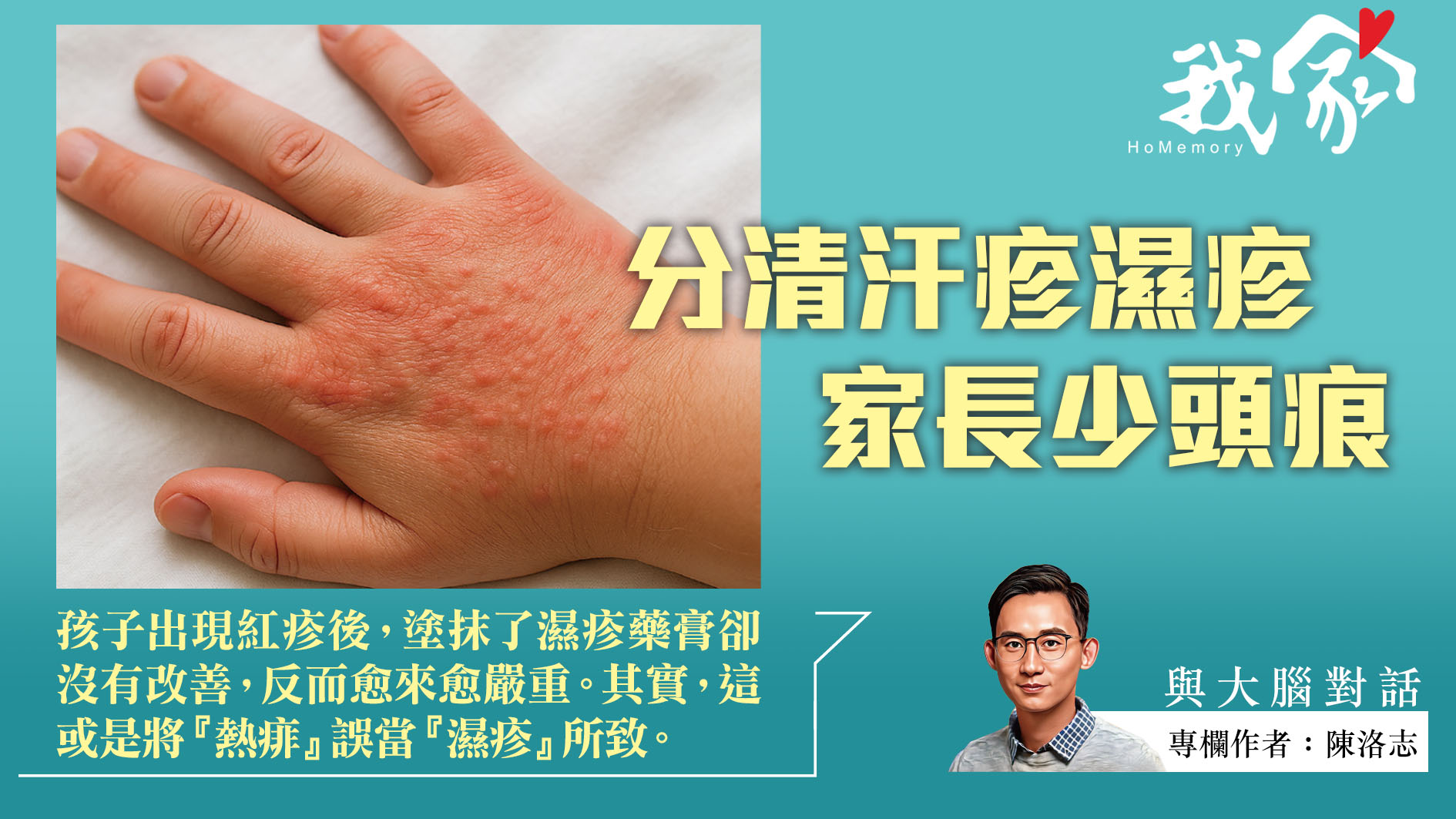 陳洛志──分清汗疹濕疹  家長少頭痕